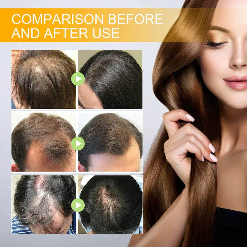 last-day-sale-50-off-lovilds-biotin-premium-hair-growth-serum-7097