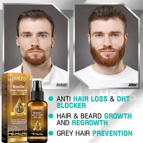 last-day-sale-50-off-lovilds-biotin-premium-hair-growth-serum-7097