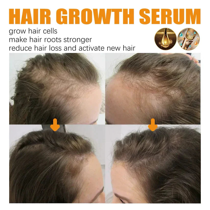 last-day-sale-50-off-lovilds-biotin-premium-hair-growth-serum-7097