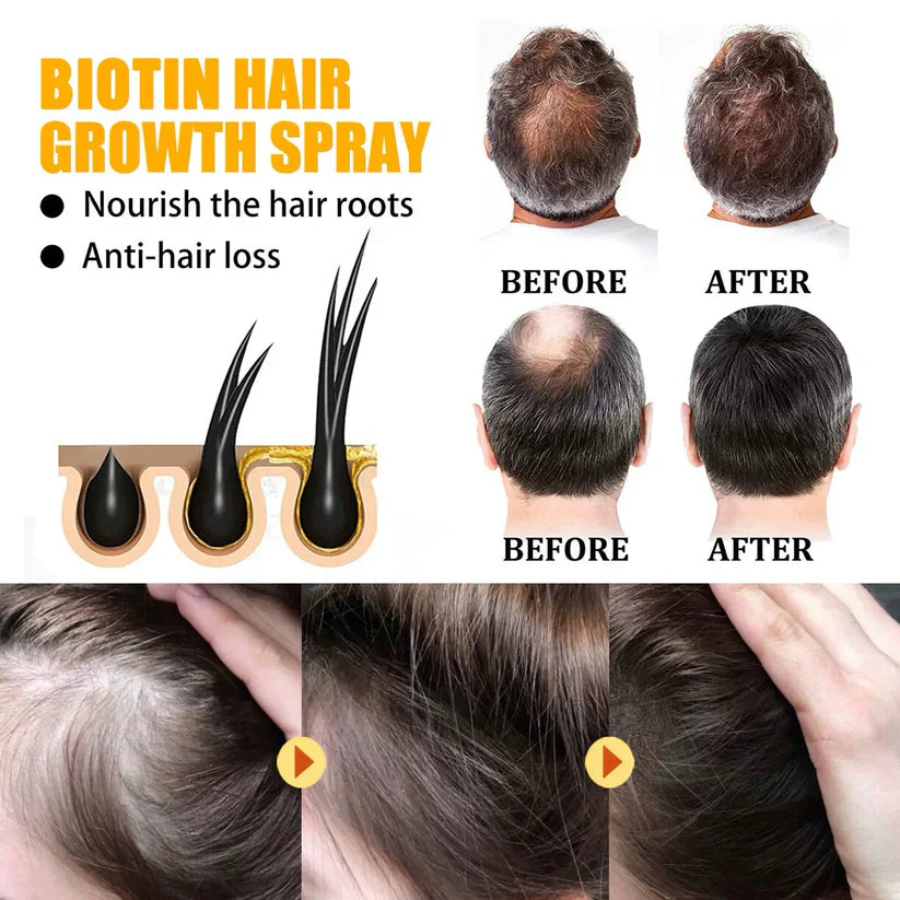 last-day-sale-50-off-lovilds-biotin-premium-hair-growth-serum-7097