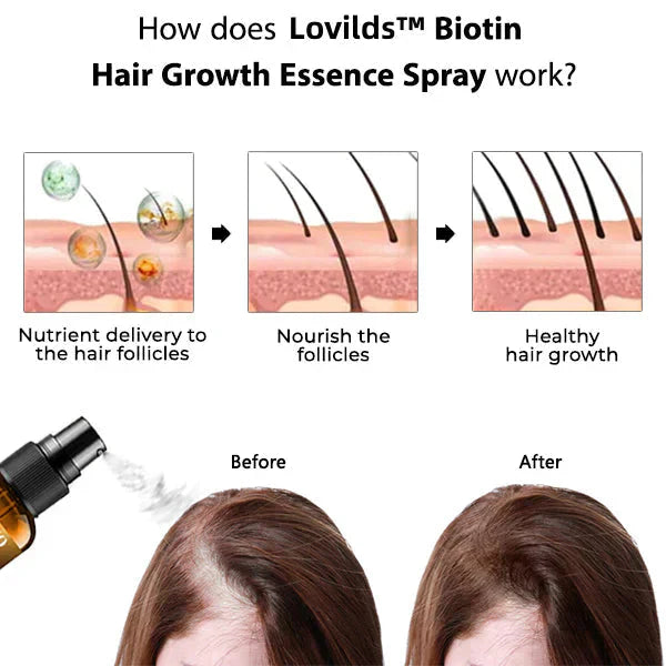 last-day-sale-50-off-lovilds-biotin-premium-hair-growth-serum-7097